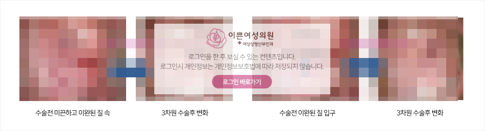 비회원
