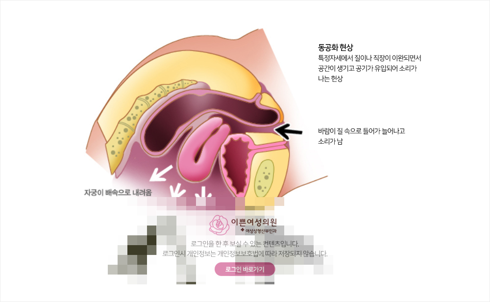 비회원