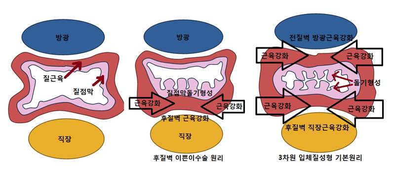 이미지명