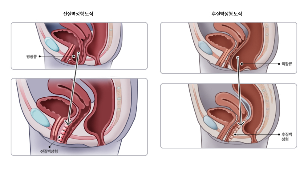 이미지명