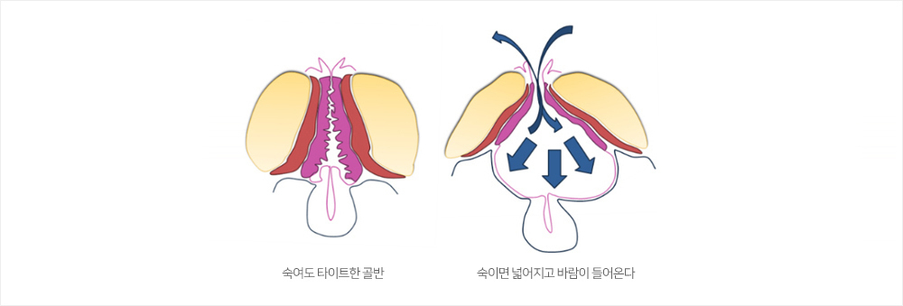 이미지명