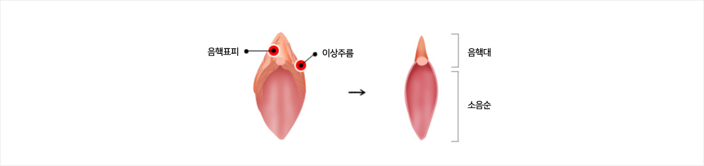 이미지명