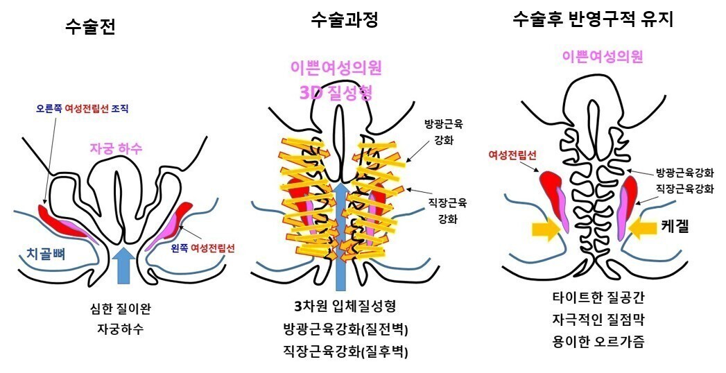 이미지명