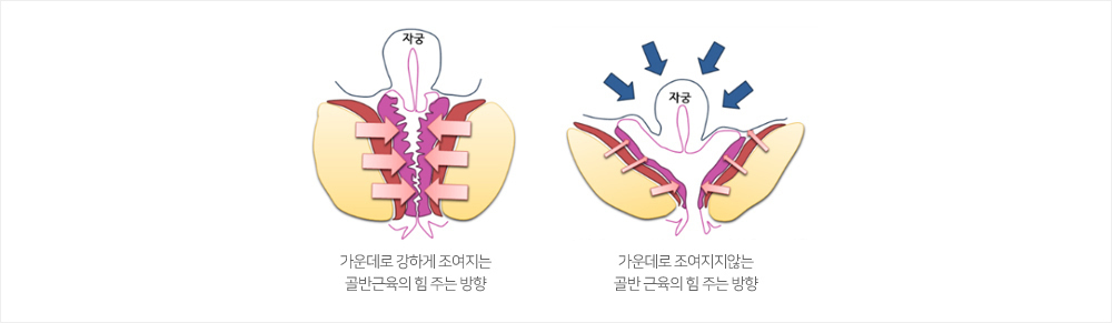 이미지명