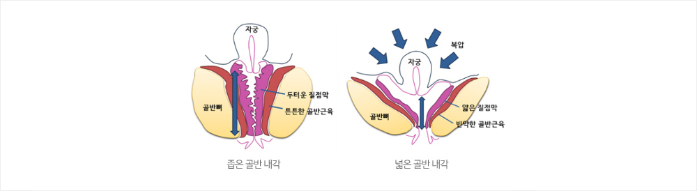이미지명