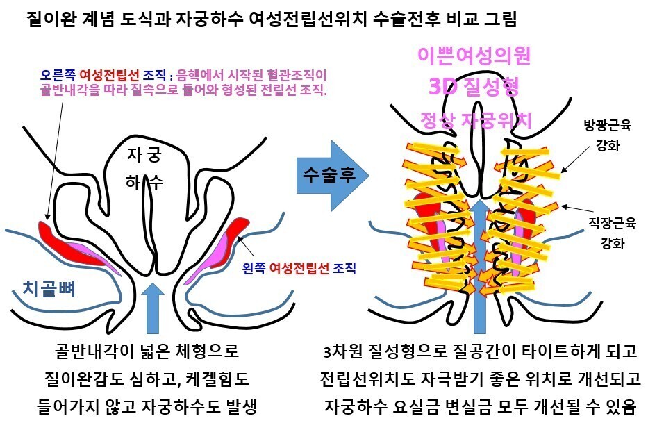 이미지명