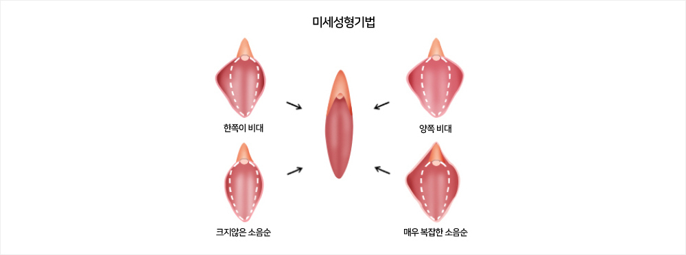 이미지명