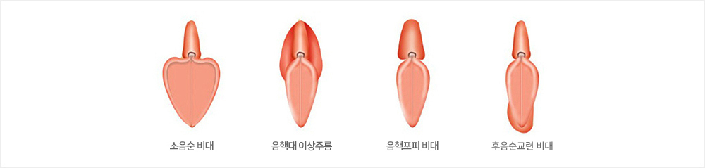 이미지명