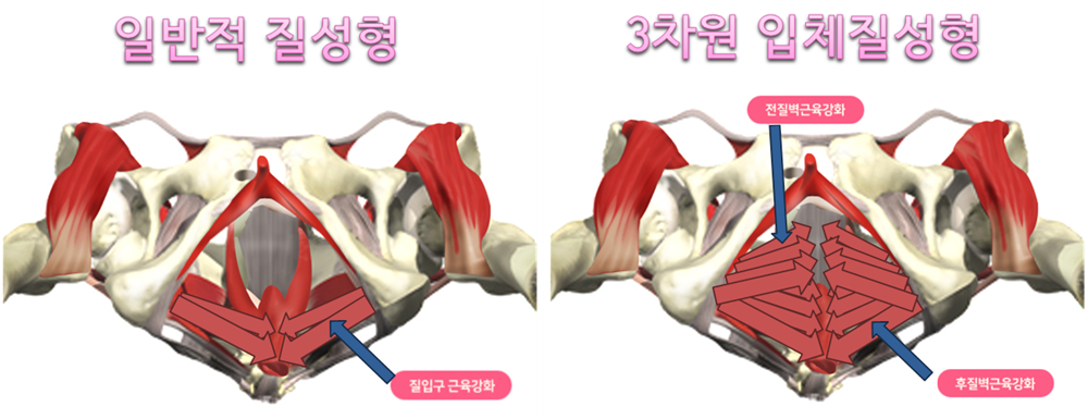 이미지명