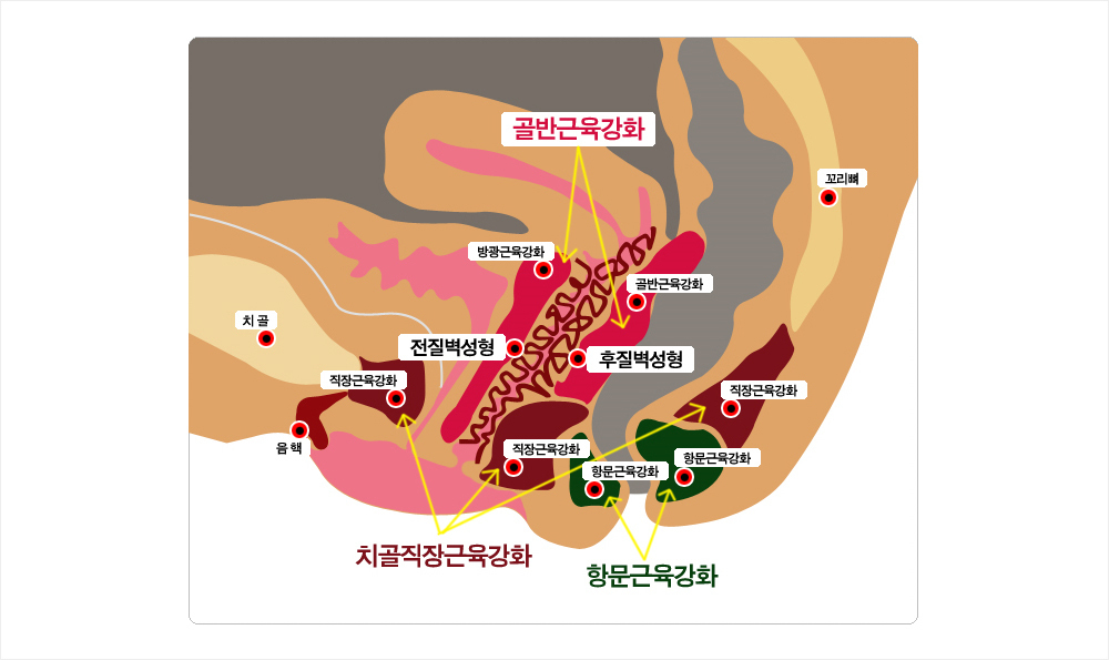 이미지명