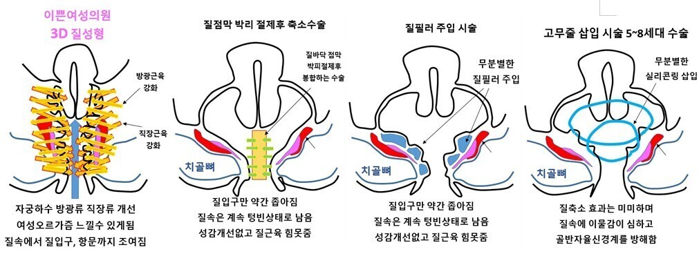 이미지명