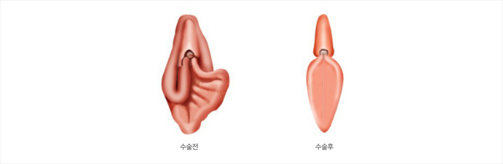 이미지명