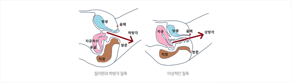 이미지명