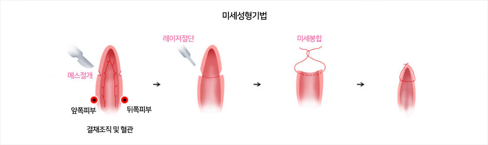 이미지명