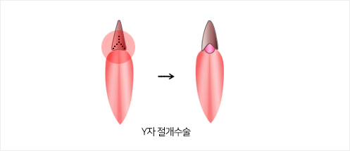 이미지명