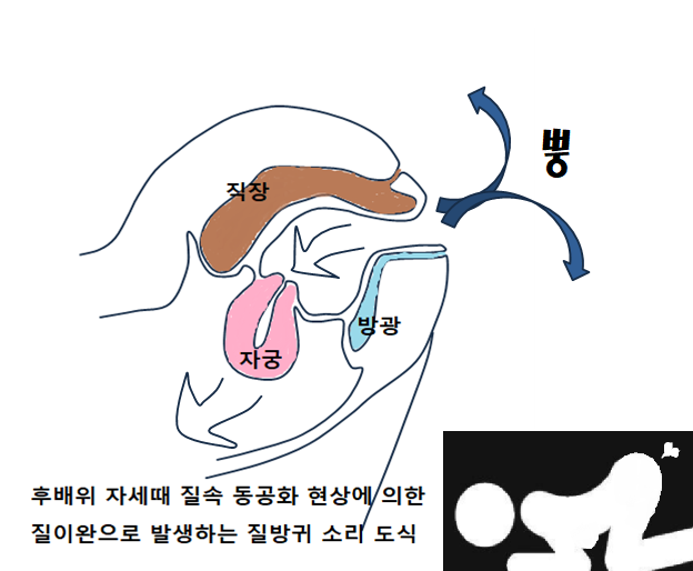 이미지명